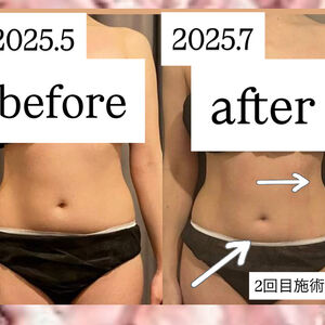 CAEBF9A1-61EB-4313-853C-C8C6D688764D