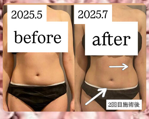 CAEBF9A1-61EB-4313-853C-C8C6D688764D