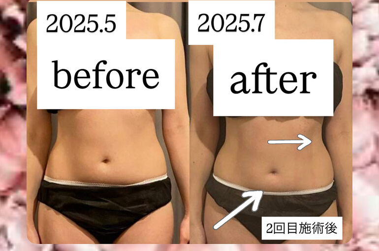 CAEBF9A1-61EB-4313-853C-C8C6D688764D