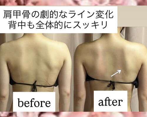 BFF6DF2E-0E58-49C6-A9C3-3F2B4EDE2768