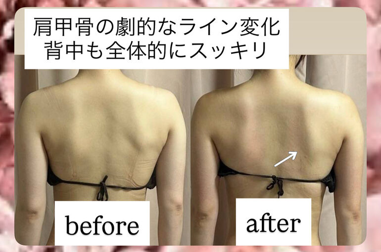 BFF6DF2E-0E58-49C6-A9C3-3F2B4EDE2768