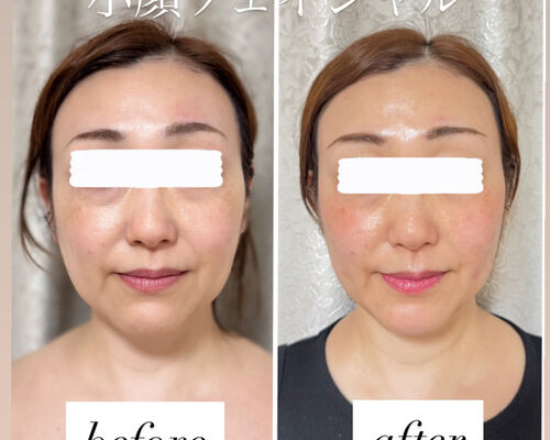 CBD436D6-0DC3-4B65-86CF-CBE94D87E51E