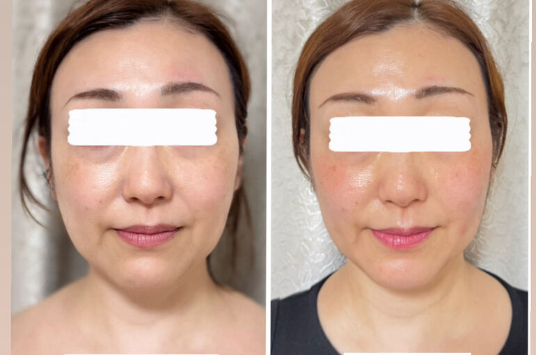 CBD436D6-0DC3-4B65-86CF-CBE94D87E51E